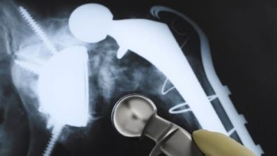 Cat leg horror surgery