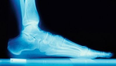 How to find the right running shoe