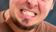 When debt goes up your teeth grind down according to Irish dentists