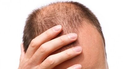 Bioxsine Blog, Week 8: We’ve reached the two month mark