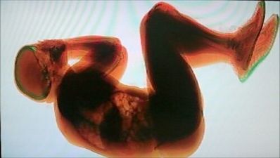 Drunk Norwegian man goes for a ride on a baggage belt, and gets X-rayed