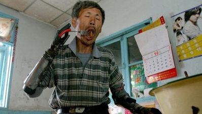 Man spends eight years making DIY bionic hands, for himself