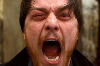 The most batshit crazy NSFW trailer we’ve seen in a long time – Filth