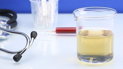 D*ck move. Italian athlete accused of using fake penis to beat a drugs test