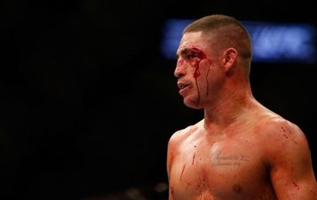 Pic: The gruesome eyecut suffered by Diego Sanchez at UFC 166 (graphic content)