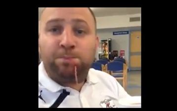 Video: This English footballer now has new party trick after freak injury