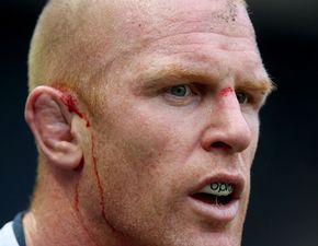 Gallery: Battered, bloody and bruised, Munster didn’t have enough to get past Edinburgh