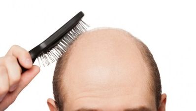 Boffins close to battling baldness