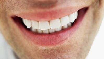 Competition: Win €1000 off Invisalign with clearbraces.ie…
