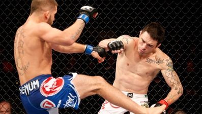 Pic: This is what a UFC fighter’s hand looked like after he put his fist through a door in frustration after losing