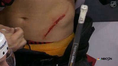 Video: That’s hockey, folks! Player gets torso slashed by skate, plays on, scores winner