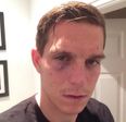 Daniel Agger shows off war wounds and brands Mignolet ‘hardcore’ after Liverpool win