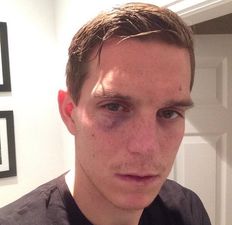 Daniel Agger shows off war wounds and brands Mignolet ‘hardcore’ after Liverpool win
