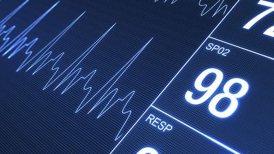 A 78-year-old man comes back to life just as he’s about to be embalmed