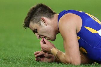 Video: Aussie Rules player loses his two front teeth during an AFL game