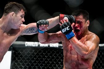 Pic: Wow! Check out these nasty before and after photos from UFC Fight Night 48