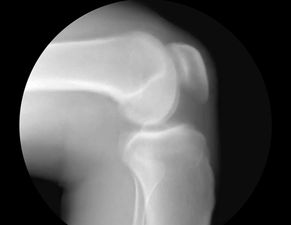 These x-ray GIFs of joints in motion are hypnotic as bedamned