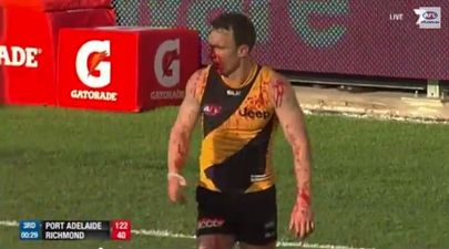 Video: AFL player cops knee to the face, ends up covered in blood