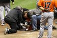 Pic: Remember that baseball player that got hit in the head on Thursday night? He’s posted pictures of his busted face (Graphic Content)