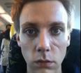 Video: Irish guy makes amazing timelapse of his recovery from plastic surgery after unprovoked drunken assault