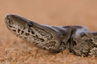 Pic: Look at what a snake bite did to a teenage girl’s leg in South America (Very graphic content)