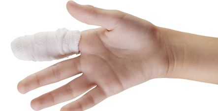 Pic: This rugby league player’s injured finger is beyond disgusting (Very graphic content)