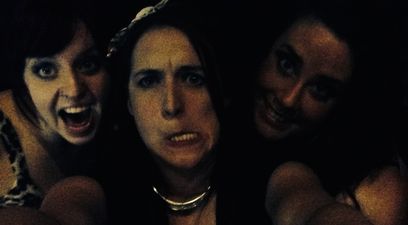 Pic: A woman in Canada passed out drunk and woke up with some fairly NSFW graphic frostbite