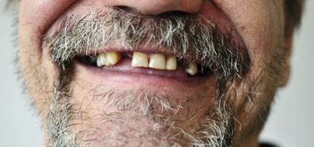 UK study finds that one in four people often go a whole day without brushing their teeth