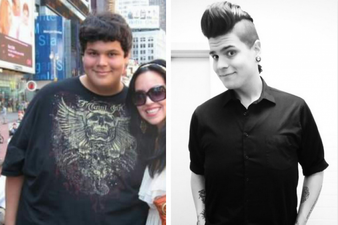 Video: Brave 22-year-old shows what happens to your body when you lose 122kg