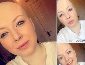 Pic: Brave 16-year-old overcomes cancer and shares these photos without her wig