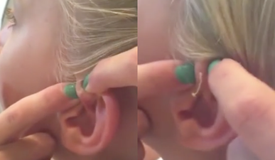 VIDEO: Girl pops a 6-year-old spot and what comes out of it is alarming