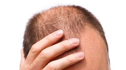 PIC: Men should avoid this one particular hairstyle because it makes you go bald