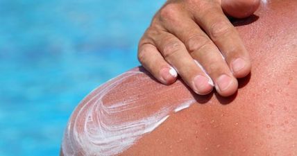 PICS: These cases of sunburn are so bad that you can almost feel the pain