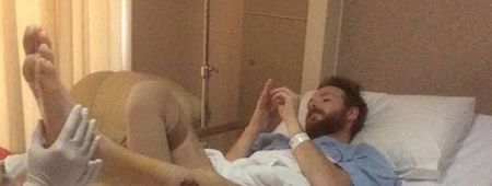 PIC: Irish man nearly lost his leg due to a flesh-eating disease (Graphic Content)