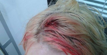 PIC: Young woman taken to hospital after being struck by election poster