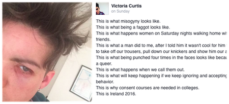 INTERVIEW: “He punched me four times in the head” – Dublin woman tells JOE about terrifying attack