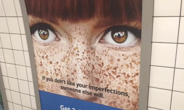 PICS: A lot of people are angry at what this dating website rates as “imperfections”