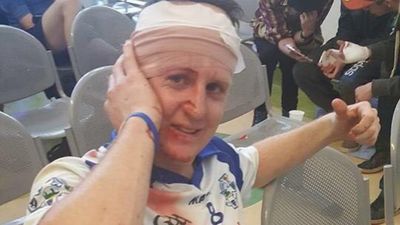 PICS: This gruesome hurling injury is not for the faint-hearted