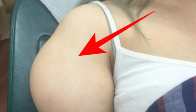 WATCH: Dr. Pimple Popper has just created her most disgusting video yet (Very Graphic)