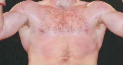 QUIZ: Can you name these Irish Olympic medallists by their winning muscles?