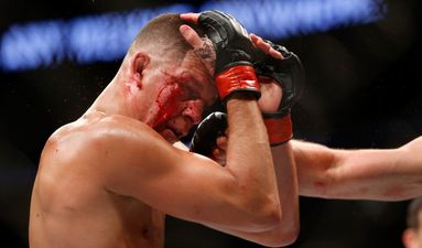 PICS: Nate Diaz’s face looked like something from a horror film during fight with Conor McGregor