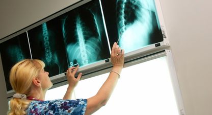 QUIZ: Can you name all these bones in the human body?