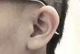 Here is why only some people have tiny holes above their ears