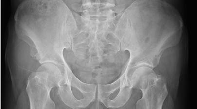 Humans don’t have penis bones because sex doesn’t last long enough