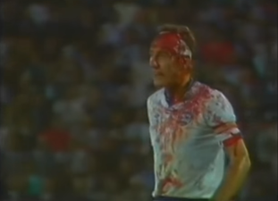 7 sports stars who ignored crazy injuries and kept playing