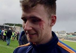 VIDEO: College hurler takes a hurl in the face and continues celebrating like a BOSS
