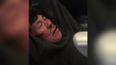 The full list of injuries that David Dao suffered after he was dragged off the United Airlines flight