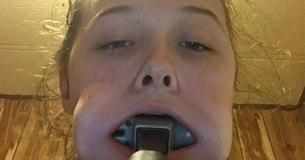 Teenager gets hammer stuck in her mouth for reasons beyond our comprehension