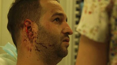 “Living in Dublin, it has always been racist.” Czech couple respond to two brutal attacks in the space of 20 days