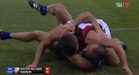 Irish AFL star facing punishment after allegedly biting opponent during scuffle